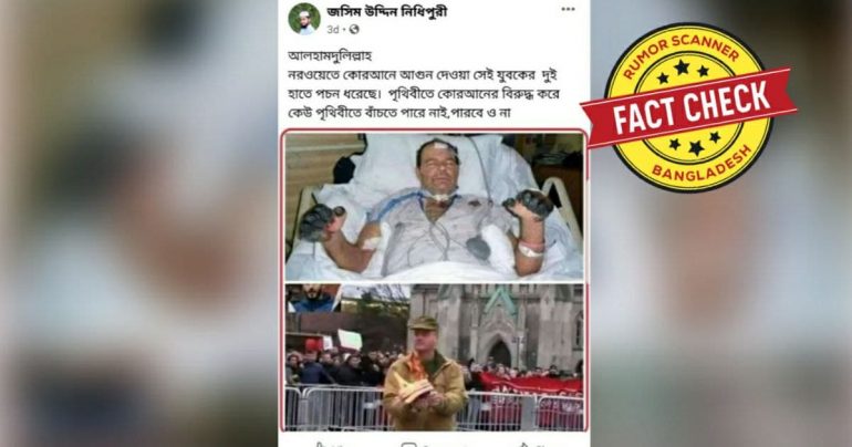 Fact Check: নরওয়েতে কোরআনে আগুন দেয়া যুবকের হাতে পচন ধরেছে দাবীতে ভিন্ন ব্যক্তির ছবি প্রচার