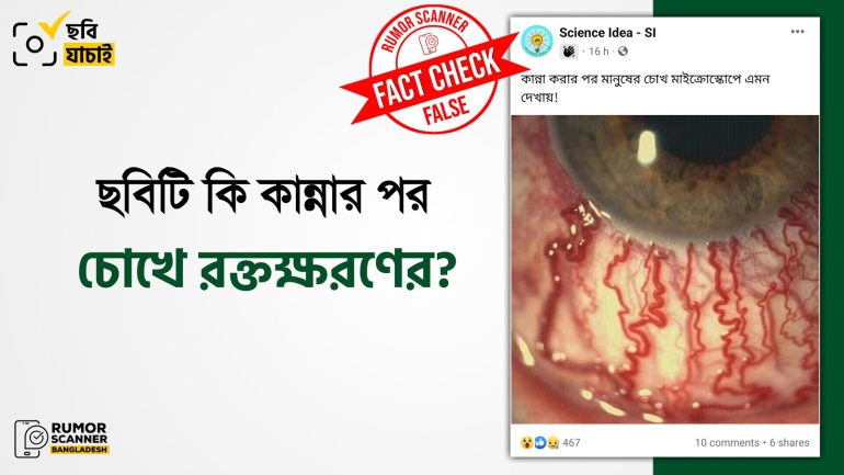ছবিটি কান্নার পর চোখের অবস্থার নয়
