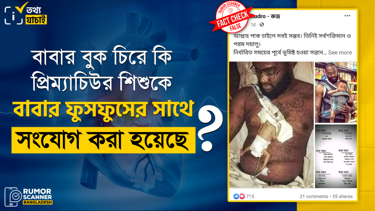 বাবার বুক ছিদ্র করে প্রিম্যাচিউর শিশুকে বাবার ফুসফুসের সাথে সংযোগ করার দাবিটি মিথ্যা